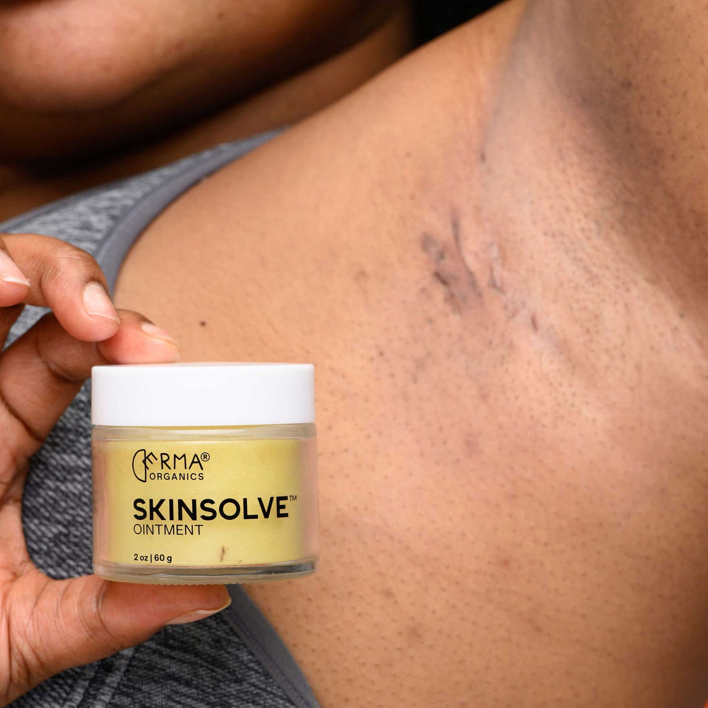 Skinsolve Ointment™