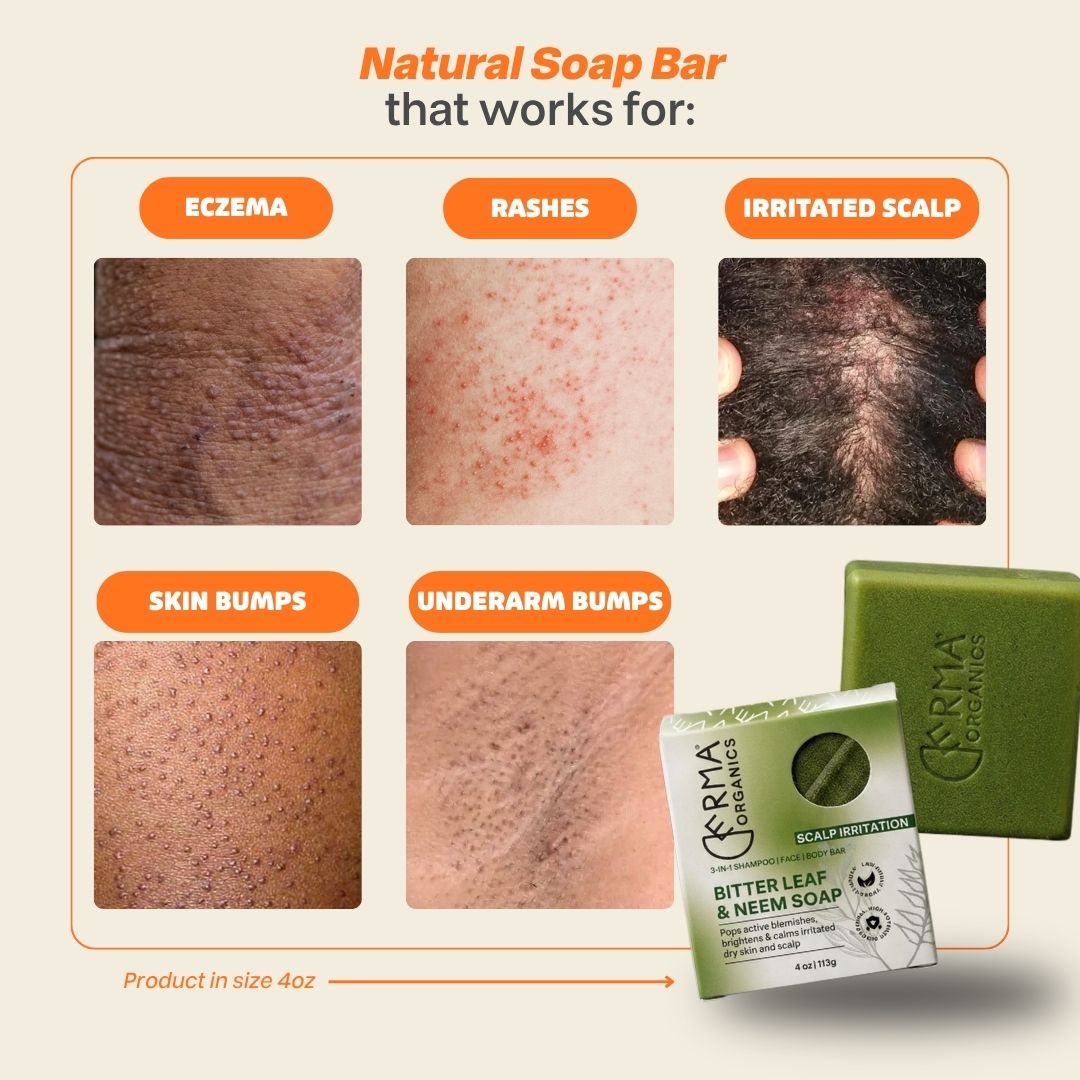 Bitter Leaf n’ Neem Soap