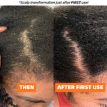 Seborrheic Dermatitis and Psoriasis Relief Duo