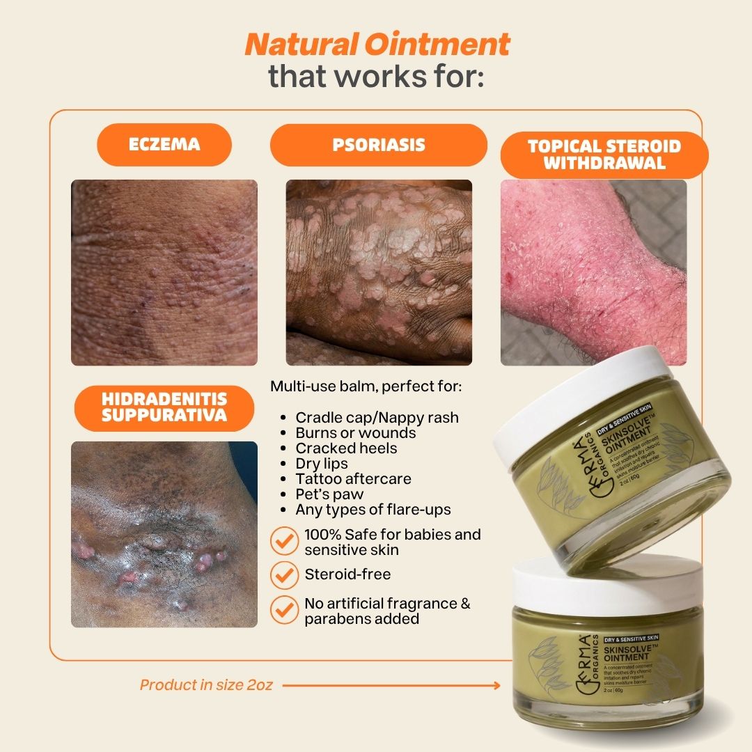 Skinsolve Ointment™