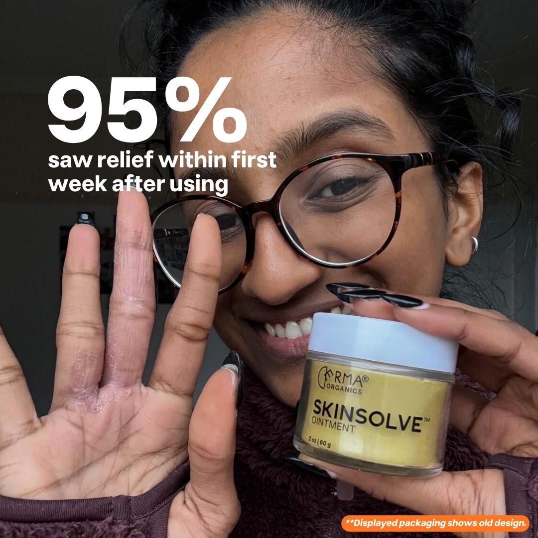 Skinsolve Ointment™