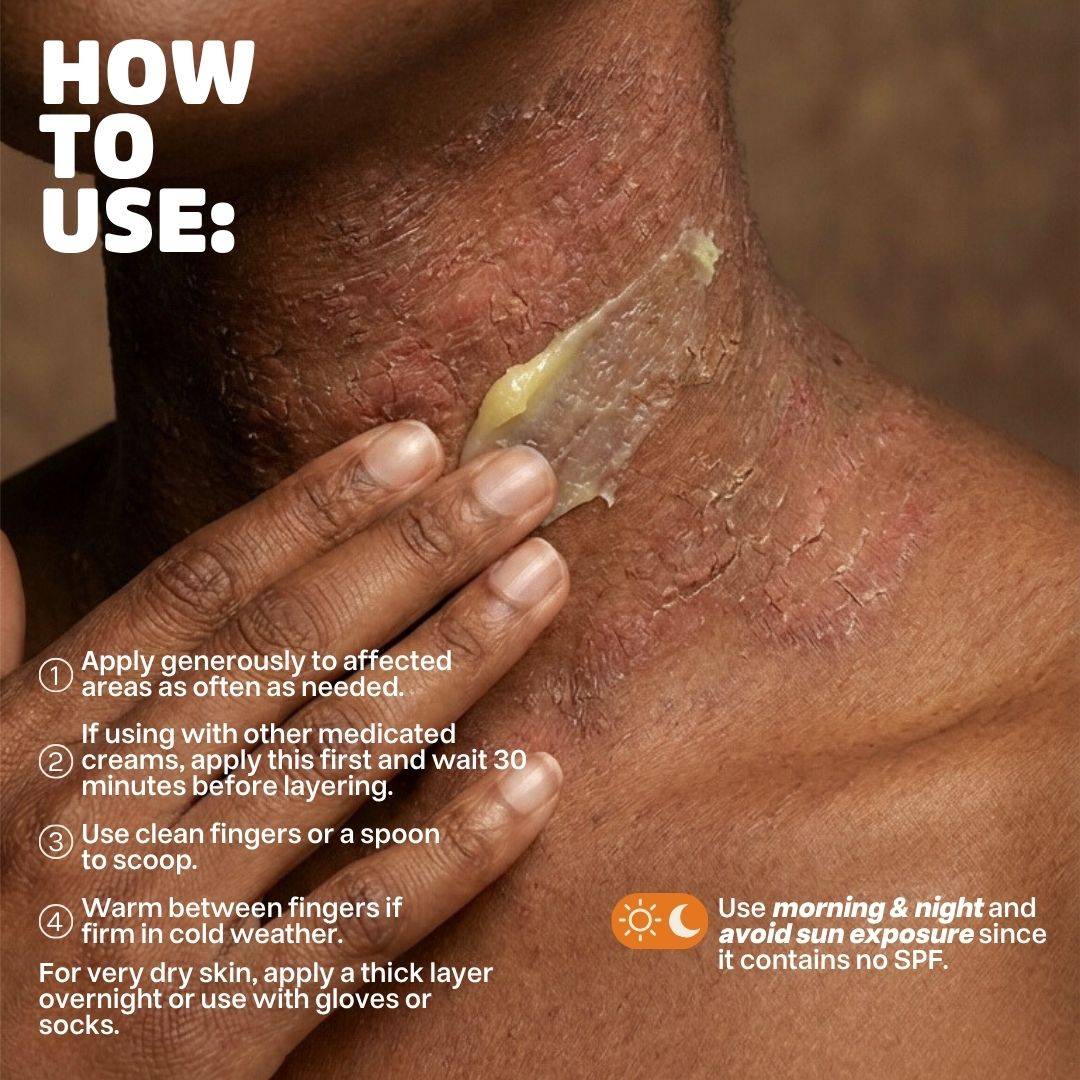 Skinsolve Ointment™