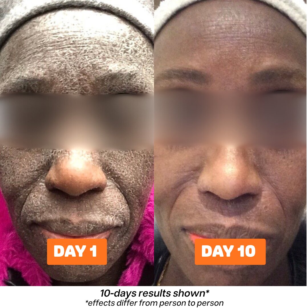 Skinsolve Ointment™